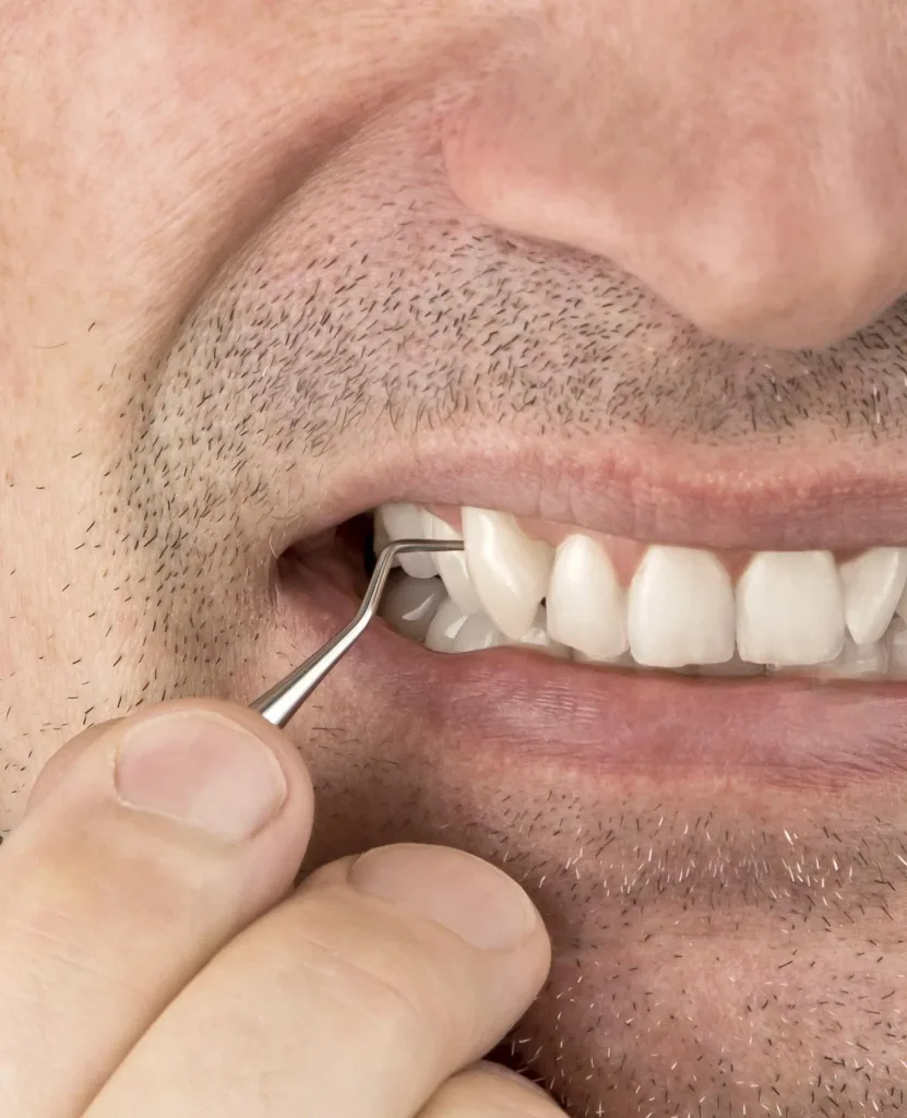 Zahnreiniger "Dental to go"