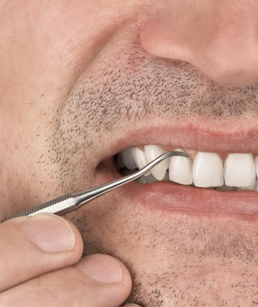Zahnreiniger "Dental to go"