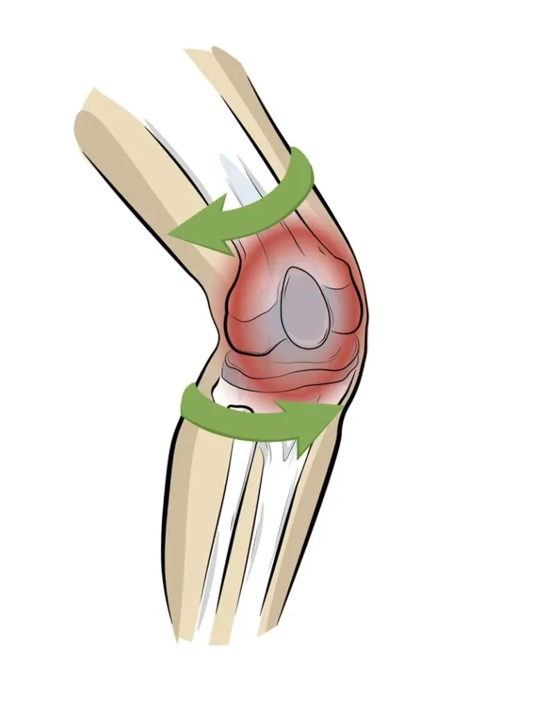 Kniebandage PatellaTec, Größe XL